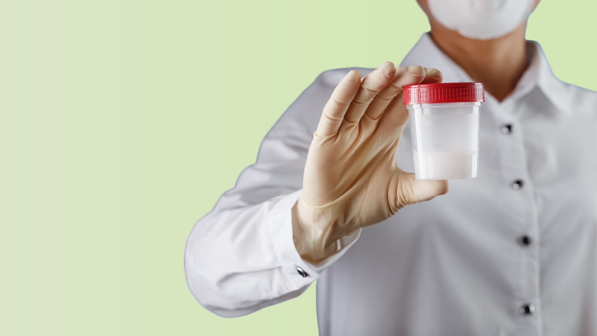 Varicocele é Grave Varicocele é Grave