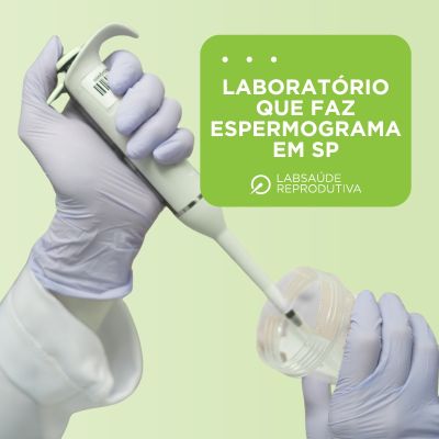 Laboratório que Faz Espermograma em SP