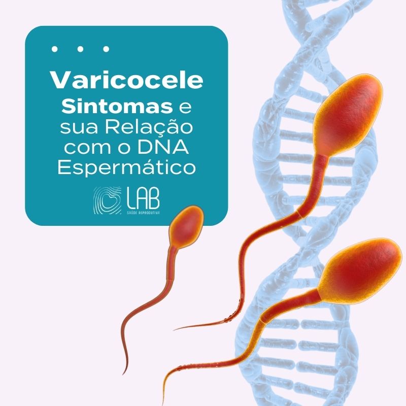 Varicocele Sintomas